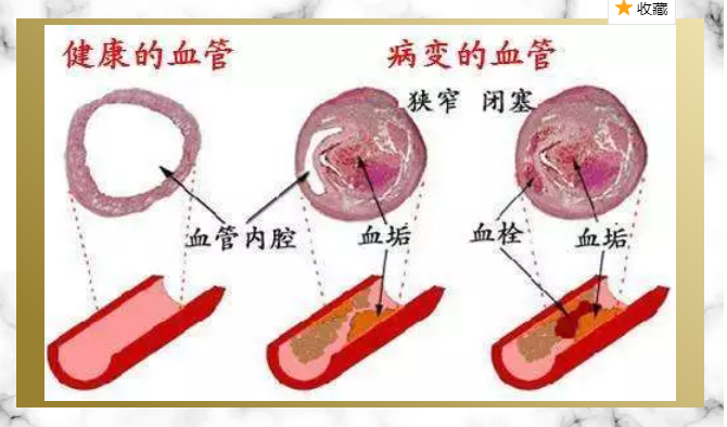 QQ截图20180503224412.png